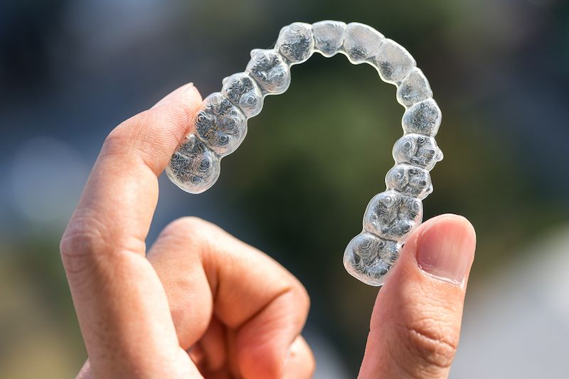 IL logan square invisalign for crooked teeth dental minds