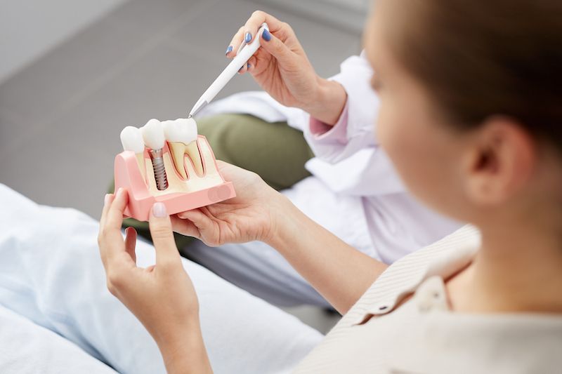 Implants vs. Bridge: Which Is Better for Missing Teeth?